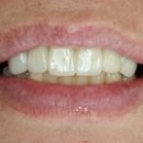 이처럼치과기공소 이미지