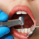 현대치과기공소 | 치과 진료 시리즈 01 : 치과 치료 왜 이렇게 비싸? – 레진, 크라운, 임플란트 진짜 비용 공개