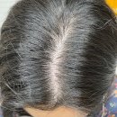 하이스칼프 | 대다모 두피샴푸1위 가려운 두피케어 마이녹셀 포어클렌징스칼프