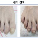더발즈