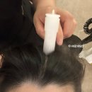 건강에 대한 고민 해결방법 | 경기 평택 두피케어 지루성 두피염 고민 해결 평택 WT메소드에서 지루성 스페셜케어 받고온 후기 전후사진O