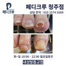 청주 사창동 네일샵 문제성발톱 전문 내성발톱 완벽 교정해드렸어요 이미지