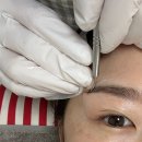청솔메디칼 | 황금동 유스에스테틱 플라즈마 물방울 특수앰플 후기