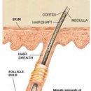 이노릭슨 이미지