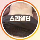 웰빙피부샾 | 일산피부관리 스킨쉘터 물광 피부에 뱃살 관리까지 추천!