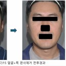 스프링봄봄