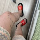 청맥헬스 | [부산 서면 청맥병원] 30대 여자 하지정맥류 수술과 후기