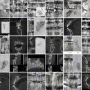 서울미네르반치과의원 이미지