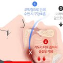 코막힘 뚫는법 원인 코 막히는 이유 알아보죠 이미지