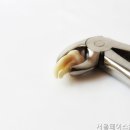 서울페이스21치과병원 | 강남치과 서울페이스21치과병원 상담만으로도 큰 도움