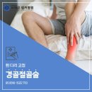 송파 무릎 관절 수술 병원, 휜 다리 교정하는 경골절골술이란? 이미지