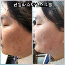 아인스메디칼 | 코타파! 3일의 기적! 3일의 놀라운 변화!! 닌셀라 펄샤이닝 진주필! 리얼후기♡