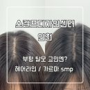 썬헤어라인 | 부평 탈모 고민엔? 부평 SMP 스칼프디자인센터(헤어라인, 가르마) 후기