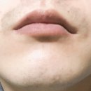 송준호레이메디의원 이미지