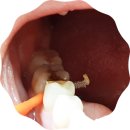 (주)크라운 아이앤씨 | 아이리버 가정용 구강세정기 솔직 사용 후기