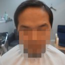 모라인 | 대구가발 모라인 당일착용후기~