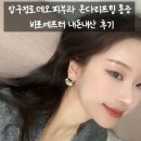 에프터10 | 압구정로데오피부과 온다리프팅 통증 비포에프터 내돈내산 후기