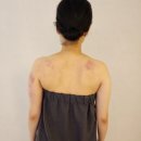 통점주차장 | 대구 범어동 피부관리 잘하는 곳 | 범어동 등관리는 영에스테틱 범어점