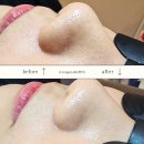 에이엘샵 | [부천] 에이엘뷰티 | 예비신부 웨딩관리 피부 관리방법부터 촉촉한 수분관리까지