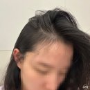 하늘이네 | 산후탈모를 위한 탈모샴푸 &#39;피토페시아&#39; 4주 후기 / 내돈내산, 하늘이네마켓