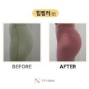 이와이의원 네이버블로그