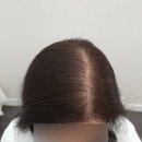 WR(인천광역시 서구)-[이음1로]-하-1 | 솜뷰티*인천 서구 가정동 여성 두피문신 가격, 왜 이렇게 저렴하게 진행할까요?