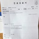 가산테라치과의원 | 광주 사랑니 발치 비용 가격 매복사랑니 전문 치과 상무지구 더블엠치과