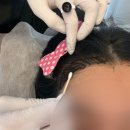 대구반영구추천 동성로 쁘띠럭키에서 헤어라인문신 받고온 후기