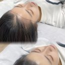 이미지헤어라인 이미지