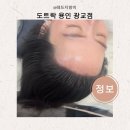 헤어라인 전후기 도트락 용인 광교점