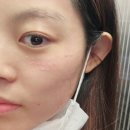 성남태평메이퓨어의원 | [메이퓨어 성남태평점] 내돈내산 리비힐샤이닝, 피코mla토닝 후기