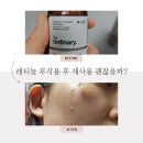 코이너리 | 디오리너리 레티놀 부작용 4주 후 재사용 괜찮을까?