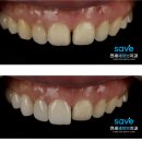 마이크로치과기공소 이미지