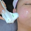 부천 피부관리 미나리에스테틱 이중턱 소멸 후기