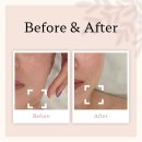 세븐일레븐노원제일점 B | 노원 피부관리 공릉동 네오래쉬 고주파 리프팅관리 크레이지015 후기