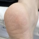 패디푸스네일