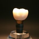 참조은치과기공소 이미지