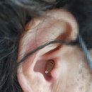 일등 보청기 이미지