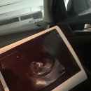 홍산의원 | [임신일기] 임신 11주 5일 초음파 &amp; 제노맘 니프티 플러스 검사 후기 (내돈내산 정상 )