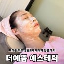 부평 더예쁨 에스테틱 생알로에 팩 수기 테라피 받은 솔직후기