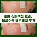 수축 | 송파 슈퍼젝션 효과, 모공수축 탄력개선 후기