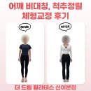 이문10 | [이문 필라테스] 라운드숄더 비포&amp;에프터 후기 / 거북목 10년 차, 필라테스로 2주 만에 달라진 회원님...