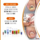 레푸스전주 이미지