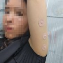 (주)메디프로 이미지