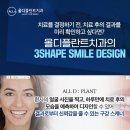 올디플란트치과의원 | 복현동치과 만족스러운 임플란트 치료를 받고 싶다면