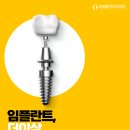 고운플란트치과의원 네이버블로그