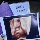 미래한국병원 | [30주차] 분당제일여성병원 입체초음파 후기 AI 미래아기 모습 프롬프트 +애기용품 준비🐣