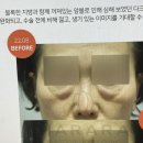 하라라성형외과의원 네이버블로그