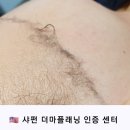 마스크로 예민해진 피부 스킨플래닝으로 관리해보셔용~(눈썹,아이라인 이벤트중.동백전,신용 카드가능) 이미지