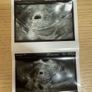 방배로28길 25 | [주간일지] 25년 5월 - 4 : 한국6주차(임신확인, 사당, 명동, 내방)